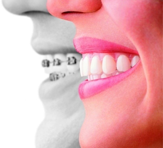 biomecanica ortodoncia