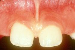 ortodonciarivero cirugia bucal