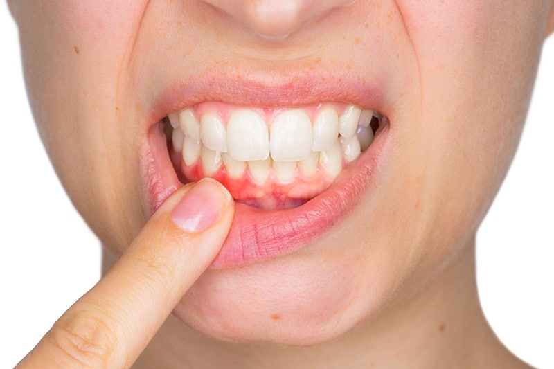 ortodonciarivero servicios periodoncia