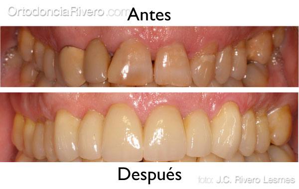 foto caso big
