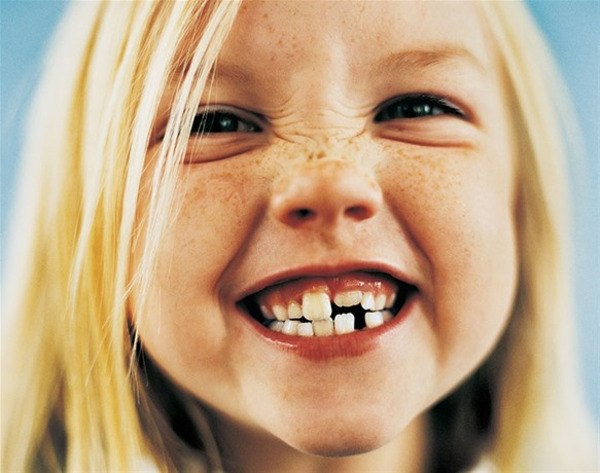 ortodoncia en niños madrid