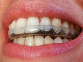 clinicas ortodoncia madrid