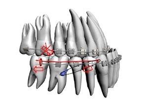 imagen descriptiva ortodoncia