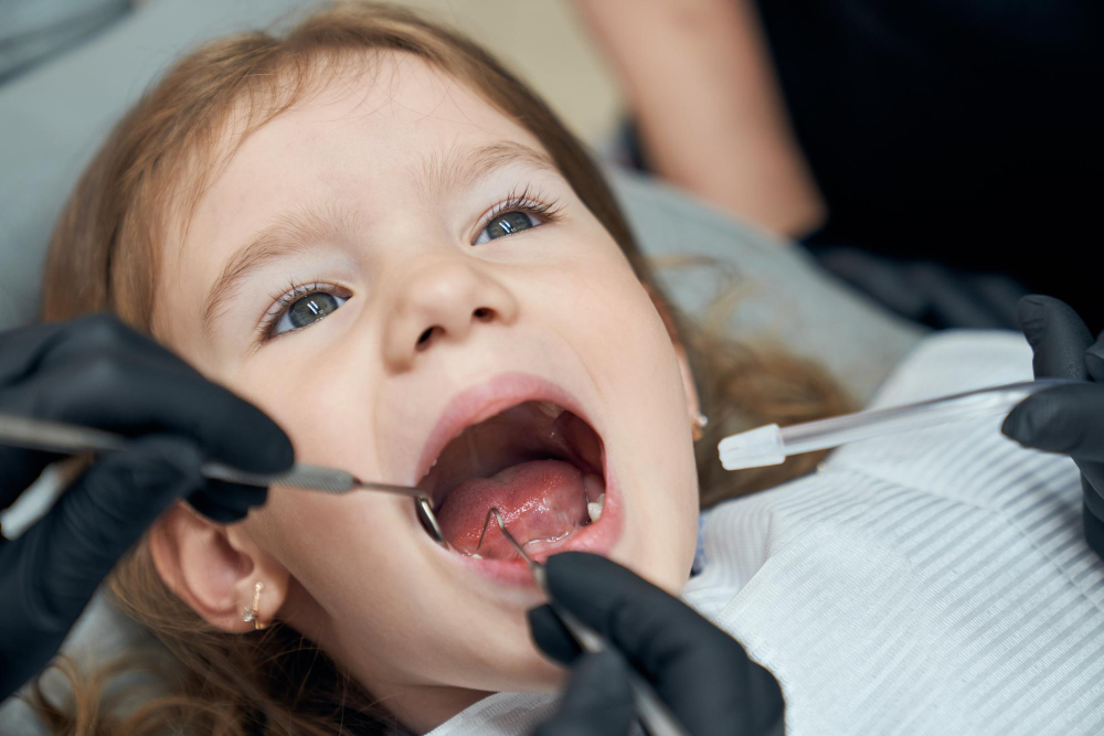 caries dientes de leche